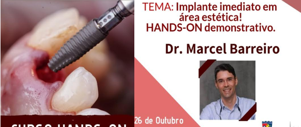 Curso Hands-on demostrativo em Implante dentário